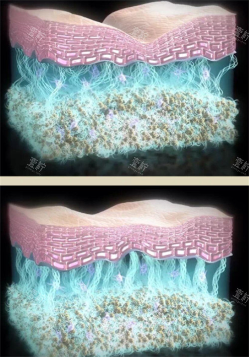 少女针注射前后皮肤变化 少女针注射前后皮肤变化