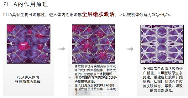 清秀针成分原理照片