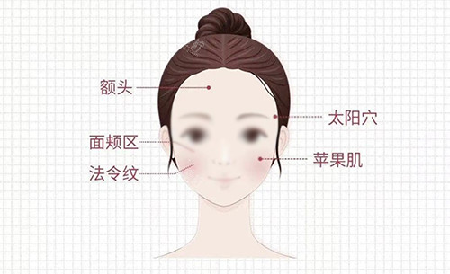 面部注射区 面部注射区