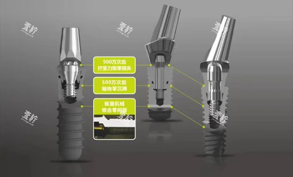 百康特种植牙怎么样