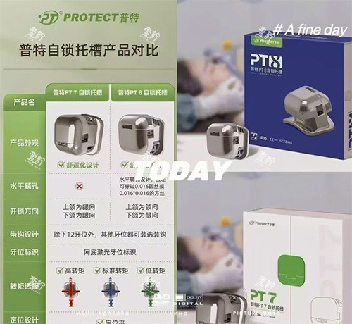 普特自锁托槽牙套照片