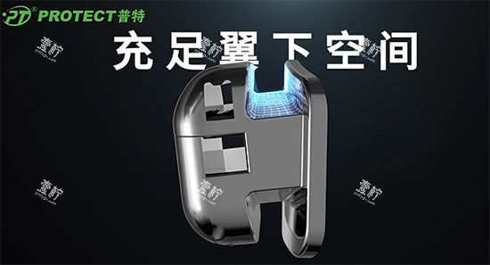 普特牙套的优势分析