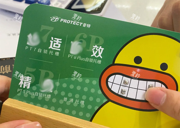 普特金属自锁牙套