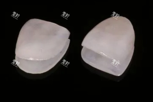 牙贴面材料卡通图