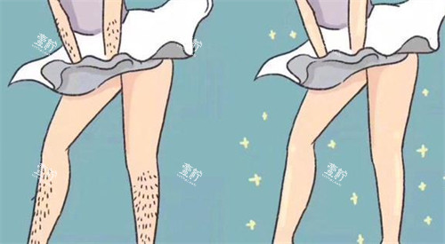 脱毛前后对比图