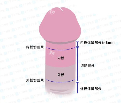 男性阴茎照片