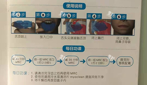 牙齿矫正MRC早期肌功能矫正说明