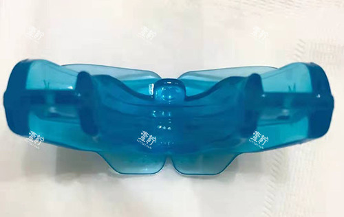 牙齿矫正MRC早期肌功能矫正器5