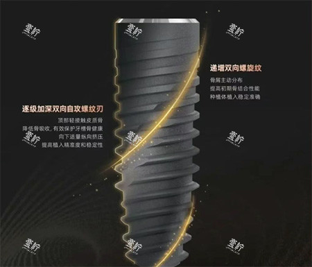 卡尔斯种植牙种植体螺纹照片