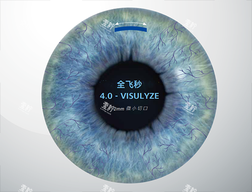 蔡司全飞秒4.0