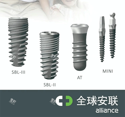 安联种植牙好不好