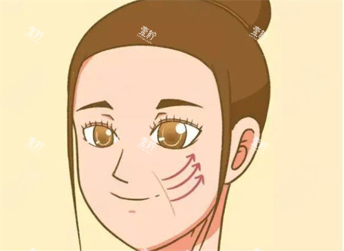 拉皮手术图片 拉皮手术图片