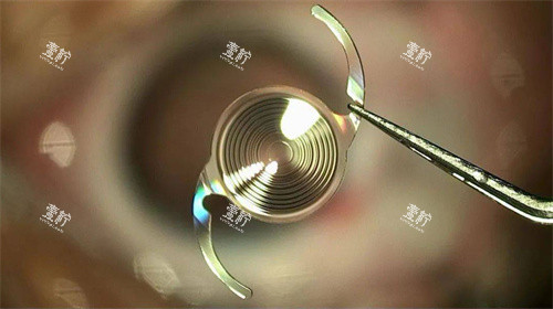 跃无极人工晶体