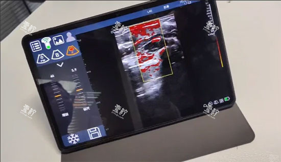 维密金雕仪器设备影像图