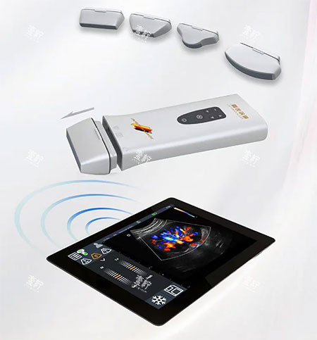 维密金雕探头照片