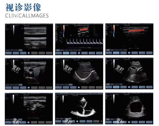 维密金雕影像照片