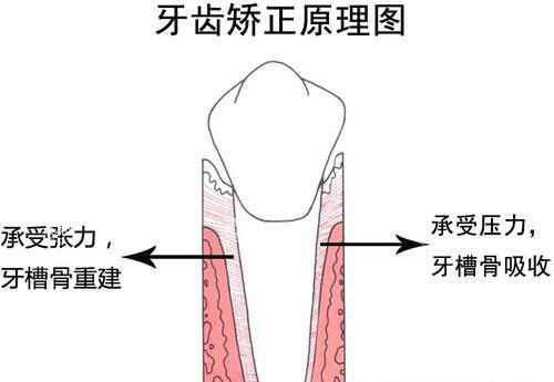 牙齿矫正正畸原理.jpg