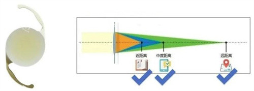 三焦晶体.jpg