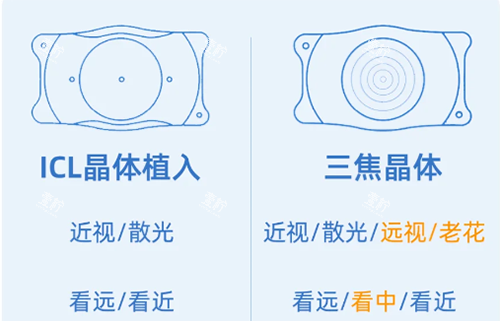 ICL和三焦晶体示意图.png
