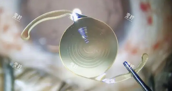 全视程和三焦点品牌深度对比：哪个更适合你的视力需求？