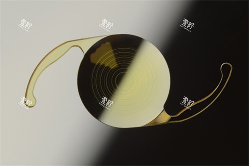三焦点人工晶体价格.jpg