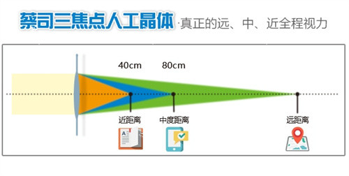 三焦点人工晶体示意图.jpg