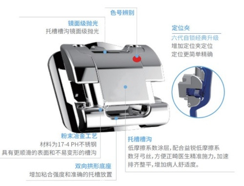 益锐UDG金属自锁托槽6.1代托槽细节优势图.jpg