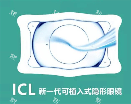 ICL晶体植入.jpg