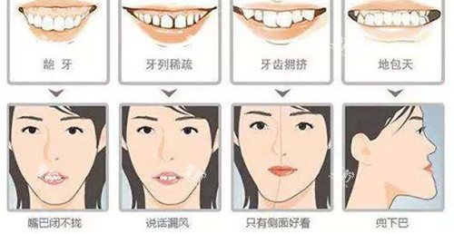 牙齿矫正脸型变化适应症.jpg 牙齿矫正脸型变化适应症.jpg