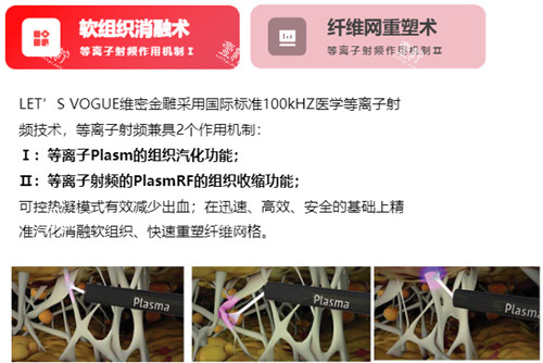 维密金雕原理介绍.jpg