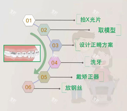牙齿矫正流程.jpg 牙齿矫正流程.jpg
