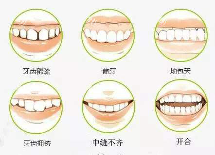 牙齿矫正不同的适应症