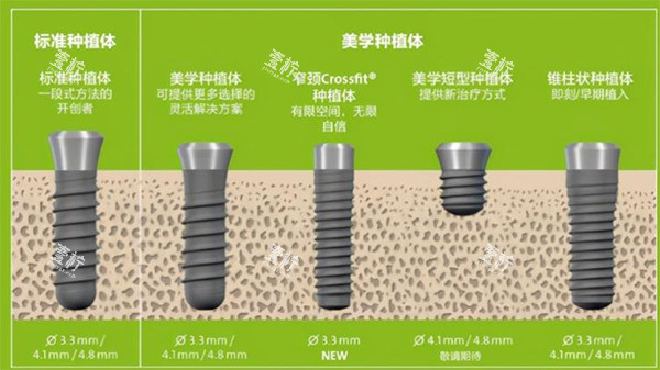 种植体规格种类参考图.jpg