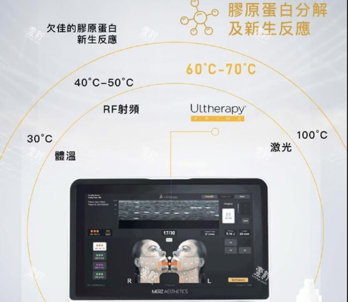 美版超声刀二代.jpg 美版超声刀二代.jpg