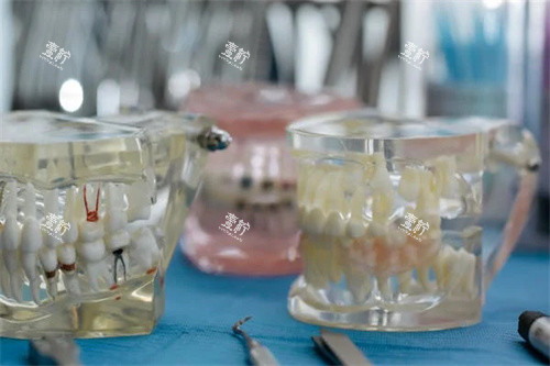 正畸模型图片展示.jpg