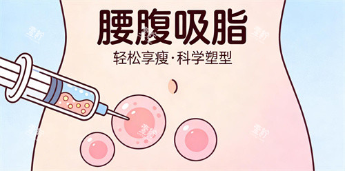 腰腹吸脂卡通展示.jpg