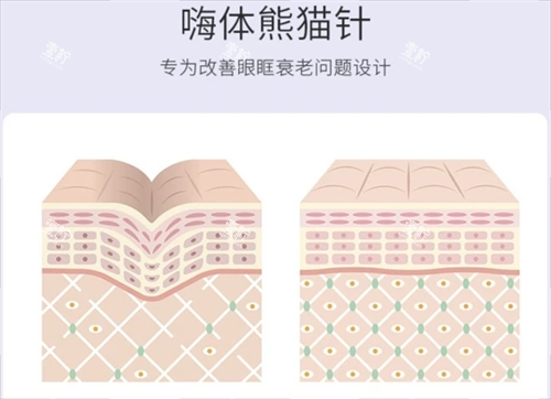 嗨体熊猫针皮肤组织动画展示.png