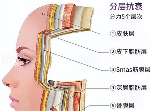 分层抗衰好不好.jpg 分层抗衰好不好.jpg