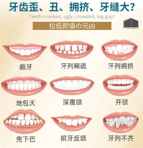 牙齿矫正适应症图示.jpg 牙齿矫正适应症图示.jpg