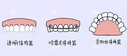 牙齿矫正正畸保持器漫画图.jpg 牙齿矫正正畸保持器漫画图.jpg