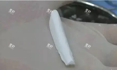 隆鼻膨体材料.jpg 隆鼻膨体材料.jpg