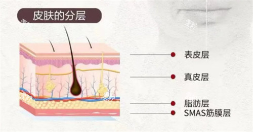 softwave索夫波适用皮肤层次.jpg