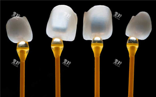 襄阳优益佳口腔怎么样？费用大概多少，这价算不算贵