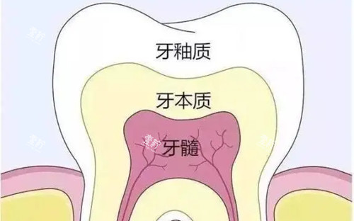 牙齿不同层次卡通示意图.jpg