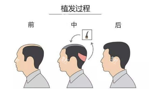 头顶加密过程示意图.jpg