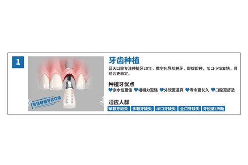 蓝天口腔种植牙优势图.jpg