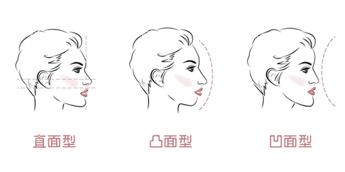 牙齿矫正面型问题.png 牙齿矫正面型问题.png