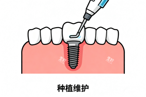 种植牙维护卡通图.png