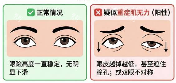 赫林现象是什么原因引起的 斜视患者身上最常见 但医生说跟大脑处理有关 这解释能信吗