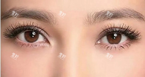 开眼角.webp.jpg 开眼角.webp.jpg